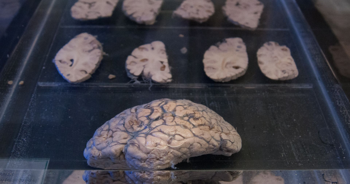 La inteligencia artificial crea el mapa cerebral más preciso hasta ahora